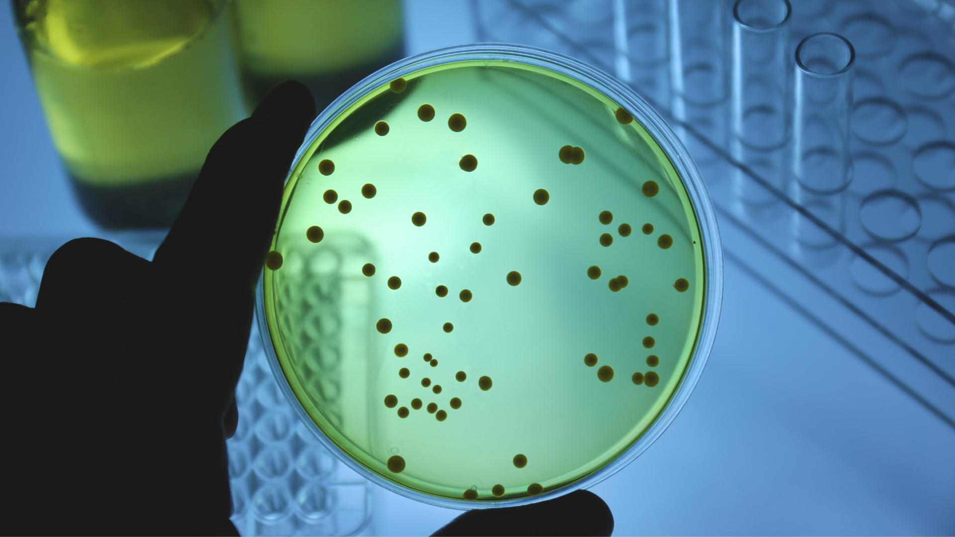 Pesquisador analisando plantas medicinais em laboratório para combater a resistência antimicrobiana e fortalecer a imunidade.